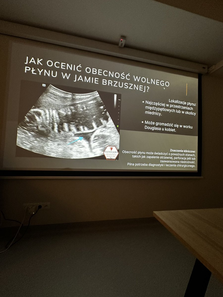 Martyna Kopiec - Ostrowska (@martynakostr) on Twitter photo Ultrasonografia POCUS staje się nie tylko narzędziem klinicznym, ale i dydaktycznym. Dzisiejsze szkolenie pokazało, jak obrazowanie przyłóżkowe może wspierać proces nauczania diagnostyki – szybciej, precyzyjniej, interaktywnie. Czekam na ciąg dalszy🙌🏻<a href="/FilipMSzymanski/">Prof. Filip M. Szymanski</a> <a href="/sadowska_b/">dr Monika Sadowska</a> Ultrasonografia POCUS staje się nie tylko narzędziem klinicznym, ale i dydaktycznym. Dzisiejsze szkolenie pokazało, jak obrazowanie przyłóżkowe może wspierać proces nauczania diagnostyki – szybciej, precyzyjniej, interaktywnie. Czekam na ciąg dalszy🙌🏻<a href="/FilipMSzymanski/">Prof. Filip M. Szymanski</a> <a href="/sadowska_b/">dr Monika Sadowska</a>