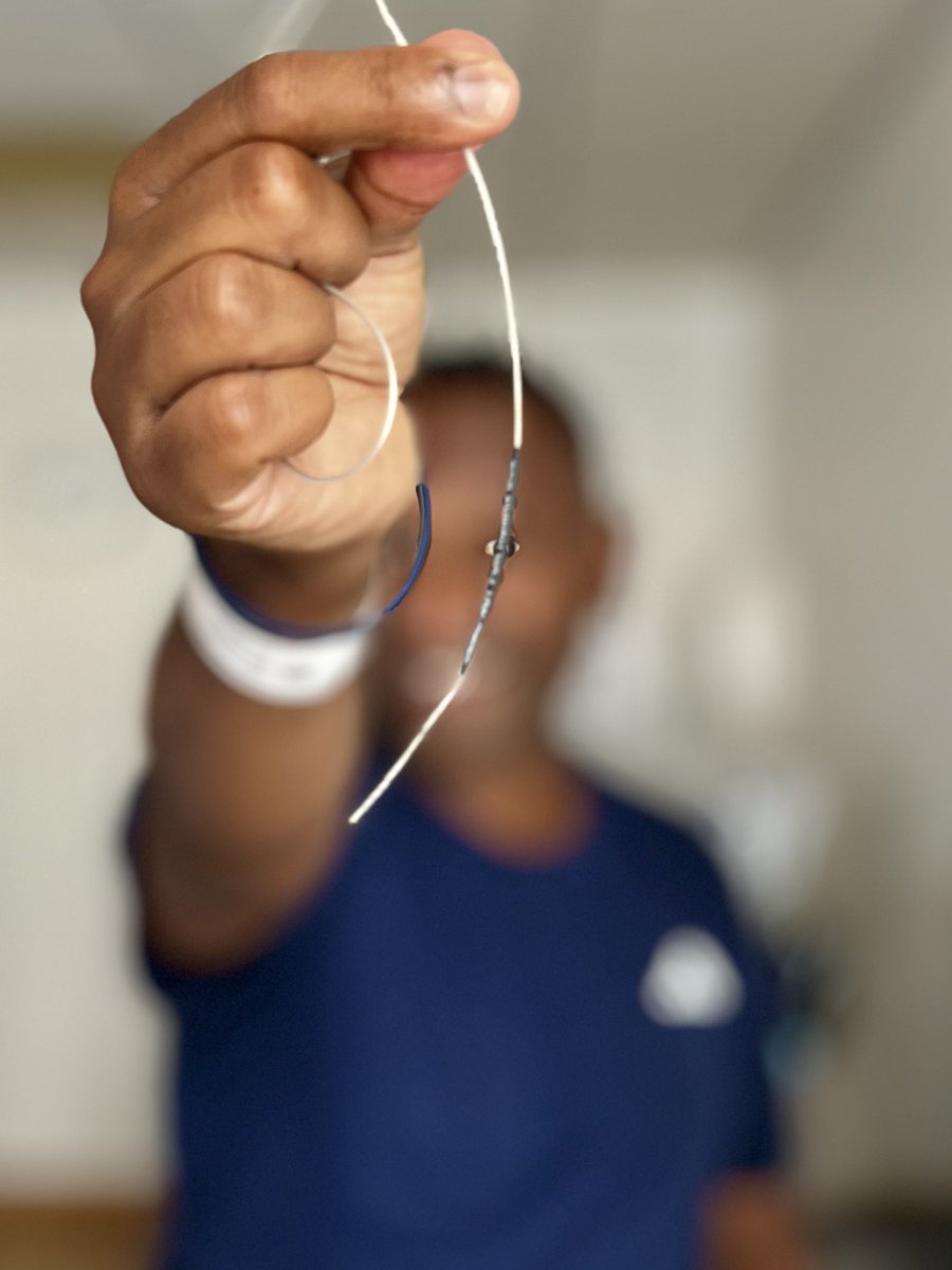 morethanatremor's tweet image. To the amazing team at this place who successfully implanted electrodes in my brain, connected to a computer in my chest and gave me some respite from my Parkinson's ...thank you for giving us our lives back' 🙏🏼🙏🏼🙏🏼💙