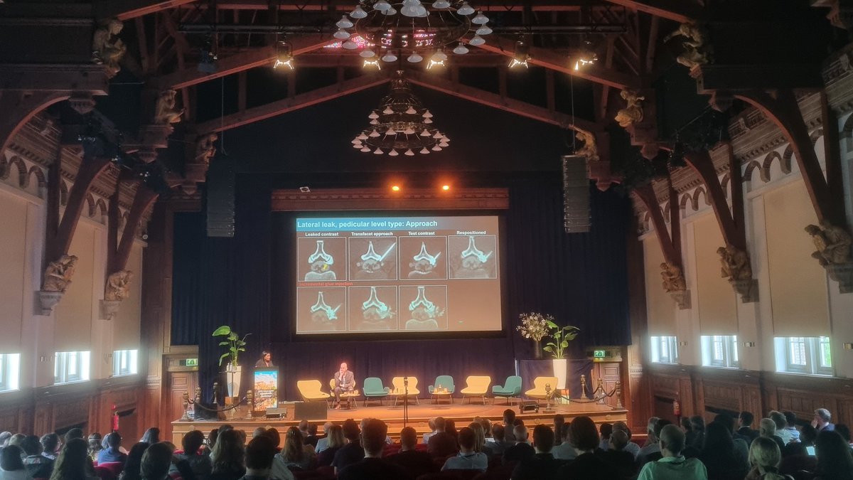KathaDCwolf's tweet image. Live from the #SIH #CSFleak intracranial hypotension conference enjoying the incredible start with @NeuroradLal @WouterSchievink @JrgenBeck #CME @UniFreiburg @CedarsSinai