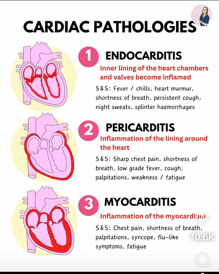 Endocarditis, Pericarditis, Myocarditis - know the key differences ...