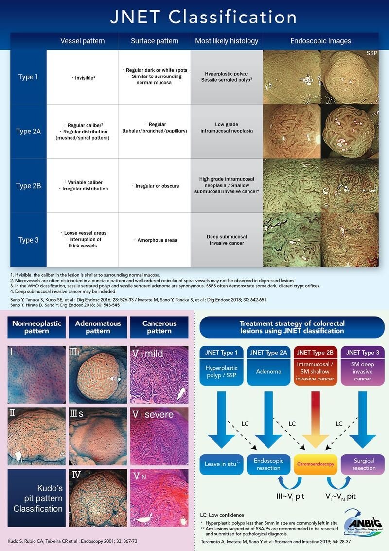 💡 JNET Classification Pearls:

Key takeaways for using this essential endoscopic tool for colorectal lesions.

1️⃣ Vessel Pattern is Key:

➡️ Type 1: Invisible/Regular fine ➡️ Type 2A: Regular caliber/distribution ➡️ Type 2B: Irregular caliber/distribution ➡️ Type 3: