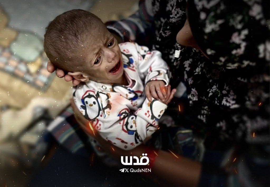 BearPause2026's tweet image. #PalestinianGenocide #PalestinianHolocaust