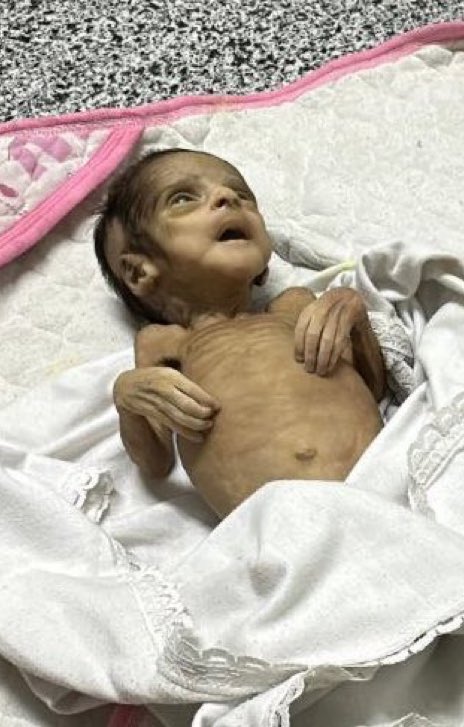 BearPause2026's tweet image. #PalestinianGenocide #PalestinianHolocaust