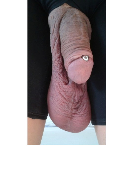 transscrotal's tweet photo. https://t.co/eqiuucmhfw