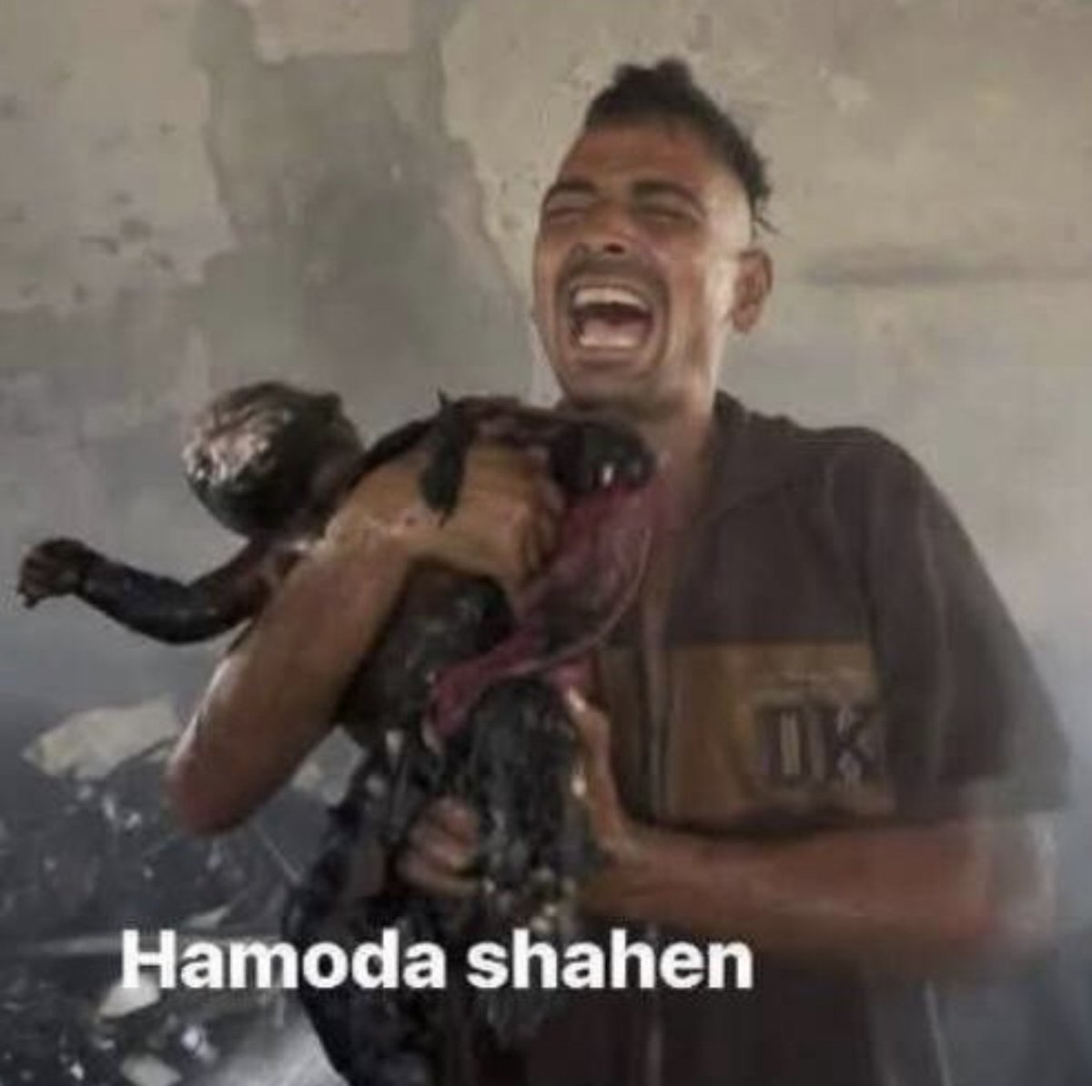 BusaidiNaser's tweet photo. أحرقت إسرائيل الإرهابية هذه الطفلة في #غزة حتى الموت !
_____ 
Terrorist Israel burned this child to death in #Gaza! https://t.co/irMHKrZuIl