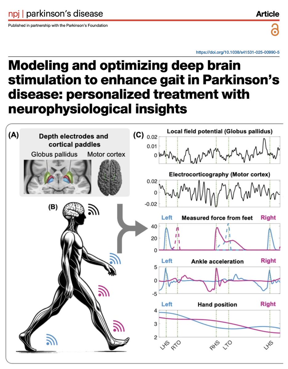 Can we reboot walking after Parkinson's disease DBS? 
Can AI teach deep brain stimulation devices to help people 'walk the walk?' A new study by Wang and colleagues in Nature Parkinson’s Disease says MAYBE. Using personalized data-driven models, researchers at UCSF have optimized