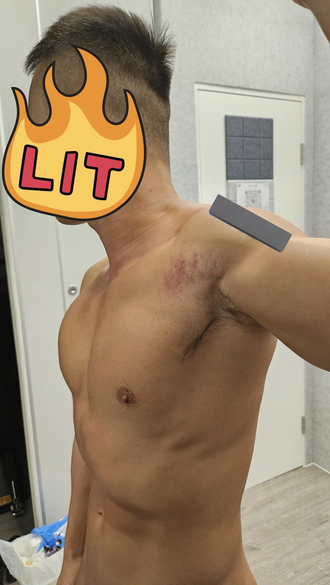 大網黃黎做筋膜刀 大家估下係邊個
😛😛