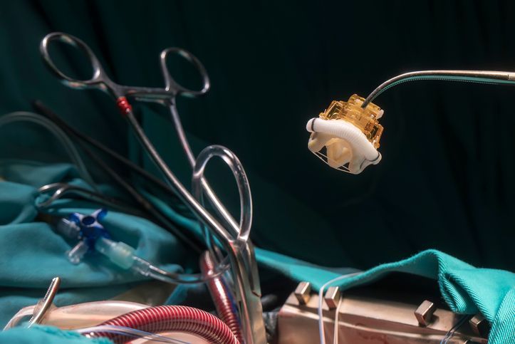 CardioCareToday's tweet image. A large study shows elective mitral valve-in-valve procedures are tied to lower 3-year mortality. Timing matters. 

Read More: cardiocaretoday.com/post/mitral-va… 

⏳❤️ #Cardiology #HeartValve #MViV