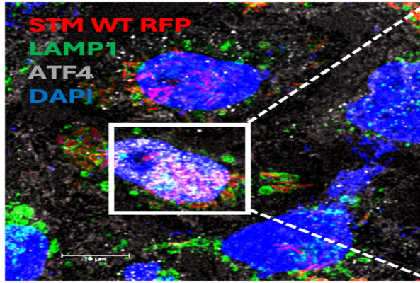IISc Bangalore (@iiscbangalore) on Twitter photo The endoplasmic reticulum (ER) of the host cell may play a role in helping Salmonella bacteria escape detection, IISc study shows.
Read more: iisc.ac.in/how-salmonella…
#IIScresearch
<a href="/DipaLab_IISc/">Prof. Dipshikha Chakravortty's Lab</a> The endoplasmic reticulum (ER) of the host cell may play a role in helping Salmonella bacteria escape detection, IISc study shows.
Read more: iisc.ac.in/how-salmonella…
#IIScresearch
<a href="/DipaLab_IISc/">Prof. Dipshikha Chakravortty's Lab</a>