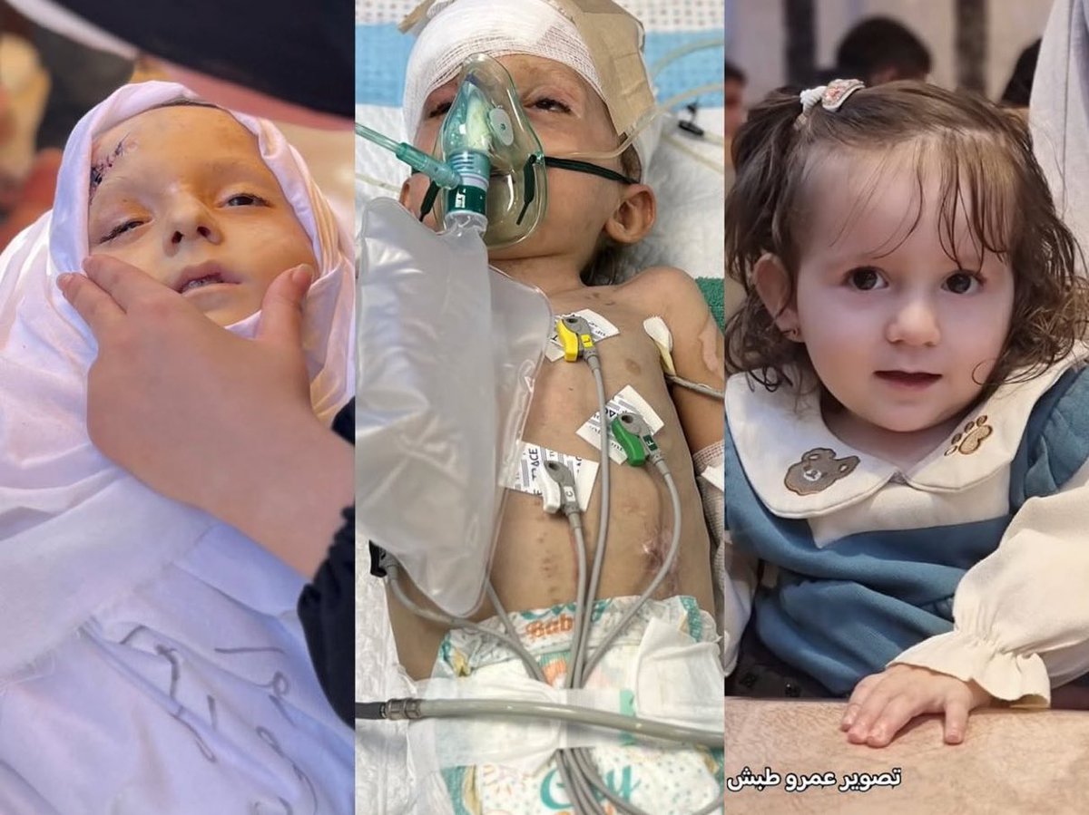 swilkinsonbc's tweet photo. 3 year-old Aseel Al-Madhoun is killed by the israelis after falling from a 5th floor during an airstrike: only her critically wounded sister survived https://t.co/N7XPwPEmia