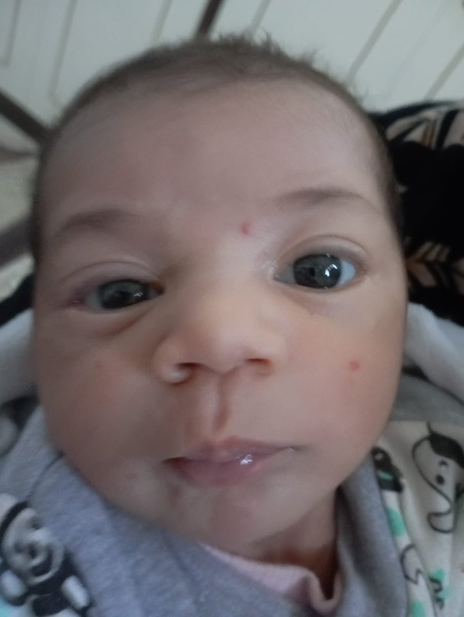 PontifexLeoXIV's tweet image. Just look at those adorable little eyes 🥺 Please donate whatever you can to help him and his family. At only five months old, genocide is all that he knows. Help him to know that there is kindness in the world by donating now fundahope.com/en/campaigns/h…