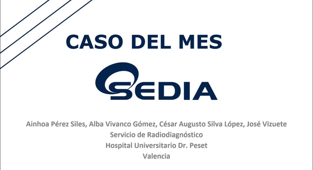 sediabdomen's tweet photo. Disponible #casosedia de junio:
“Mujer de 48a con lesión focal hepática sugestiva de quiste complejo”.
Puedes verlo en https://t.co/dOR2AH2Yh7
Si sabes la respuesta envíala. Podrás participar para conseguir una inscripción gratis para el #congresosedia2026 https://t.co/yUmtAkC0o1