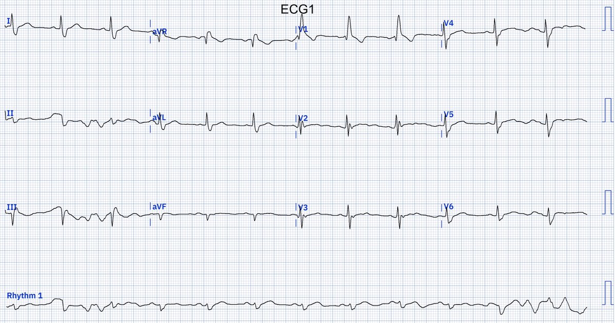 🫀EcgOxford tweet media