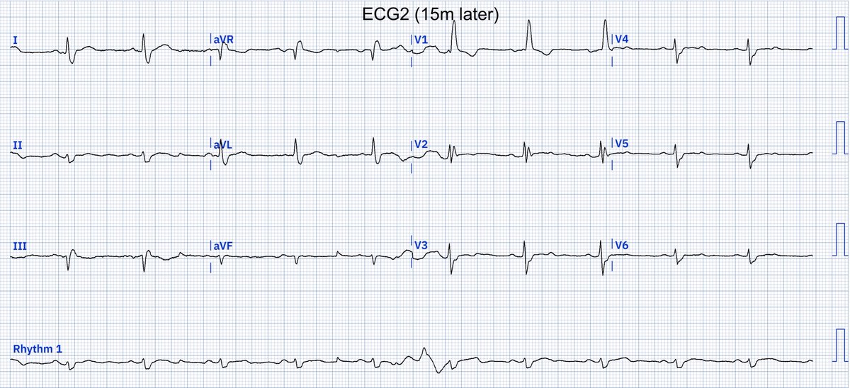 🫀EcgOxford tweet media