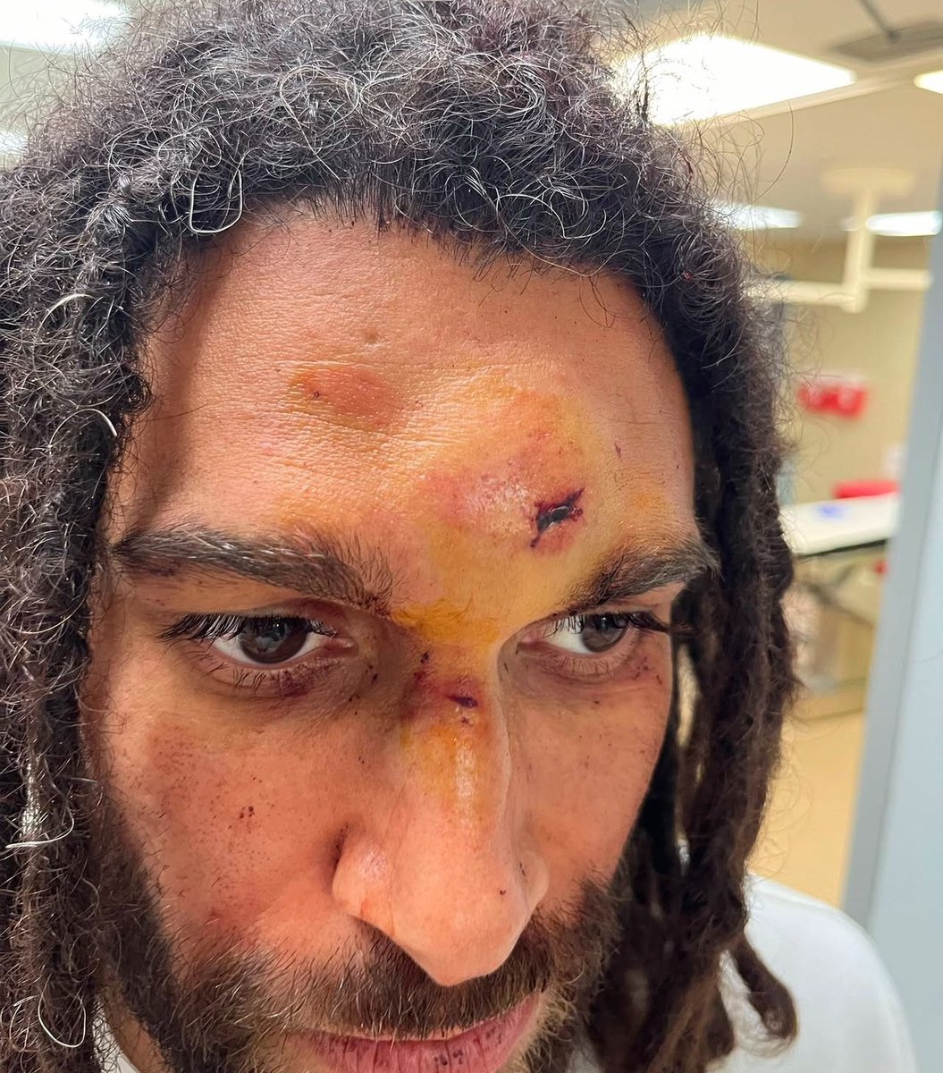 gaboramospr's tweet photo. Brutalidad policiaca contra el brother Prospe. Una de las personas más humildes y con mayor amor a nuestro archipiélago que conozco. HAGÁMOSLO VIRAL. Esto pasó en el cuartel 266 de Santurce. 

Esta lucha no es solo mediática, es en la calle. Este gobierno a puesto a su disposición TODOS sus recursos para intentar callarnos.