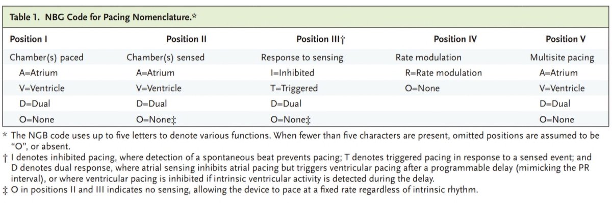 Dr. FEVI🫀🩺 (@javier20ch) on Twitter photo ⚙️🫀 Revisión actualizada sobre Marcapasos en <a href="/NEJMEvidence/">NEJM Evidence</a> (2025).
▪️ Indicaciones actuales y modos de estimulación.
▪️ Marcapasos sin cables, resincronización y estimulación del sistema de conducción (His–LBBAP).
▪️ Limitaciones, complicaciones y futuro del pacing fisiológico. ⚙️🫀 Revisión actualizada sobre Marcapasos en <a href="/NEJMEvidence/">NEJM Evidence</a> (2025).
▪️ Indicaciones actuales y modos de estimulación.
▪️ Marcapasos sin cables, resincronización y estimulación del sistema de conducción (His–LBBAP).
▪️ Limitaciones, complicaciones y futuro del pacing fisiológico.