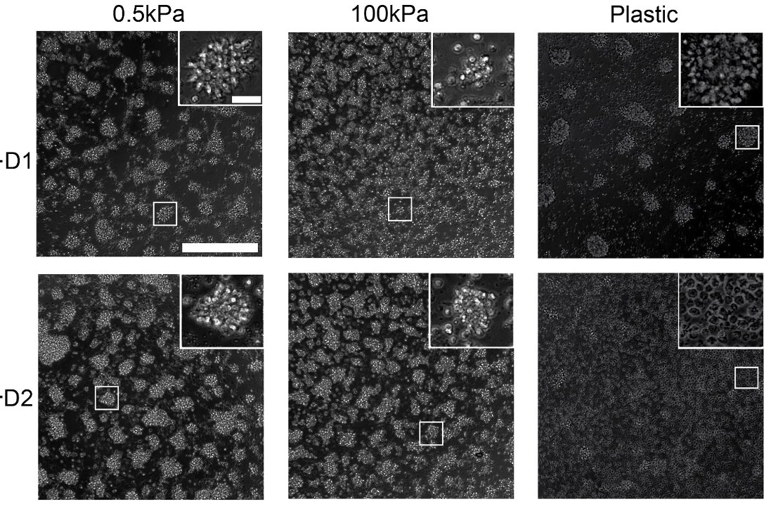 deniswirtz's tweet image. Immune cells do crazy things...Monocytes form ordered patterns on soft matrix via Turing-like local activation and global inhibition.
Like active materials, only better.
More here: biorxiv.org/content/10.110…
Will appear soon.