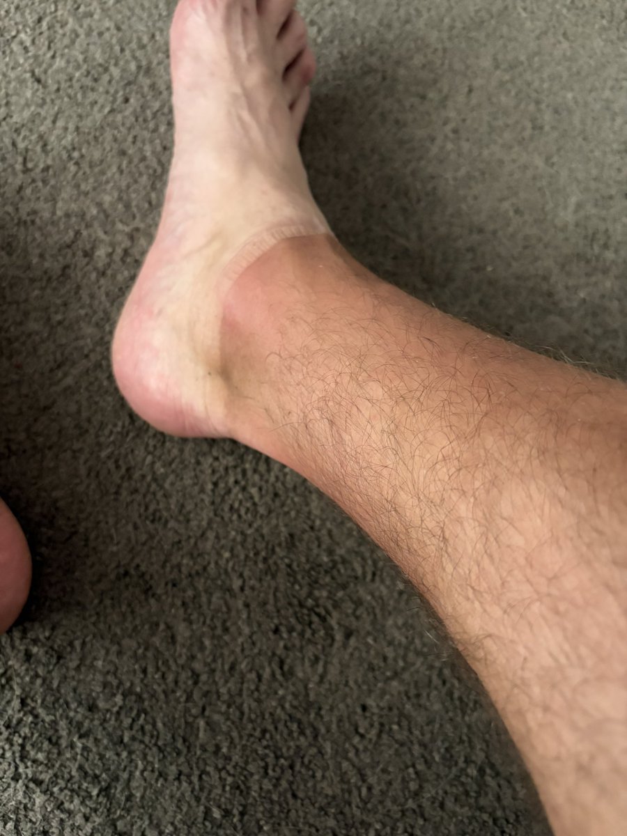 Beakroast's tweet image. Final tournament of the season ! Burnt to fuck, and dumped out on pens !
Love a tournament I do 😂😂