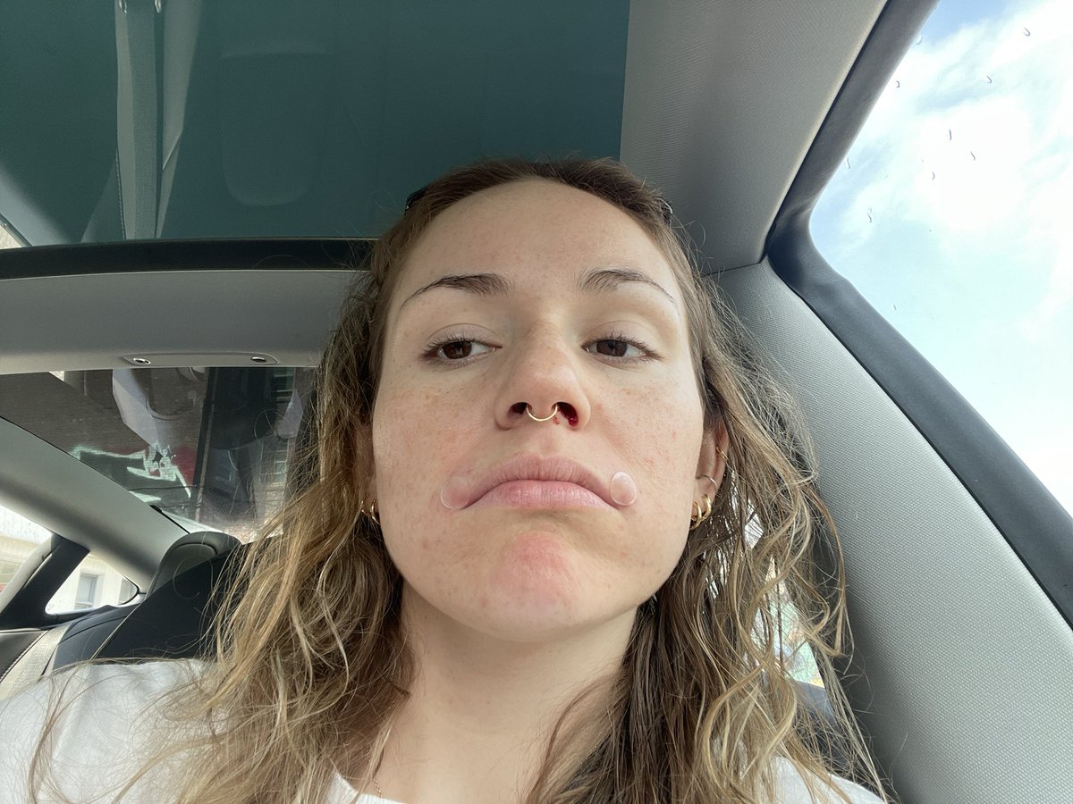 hotgirlcarol's tweet image. my bf really thought he pulled a bad bitch and all he ended up w was a ldr where the one time a month he gets to see me i pull up w double lip pimples a bloody nose and complain about my stomach ache the whole time