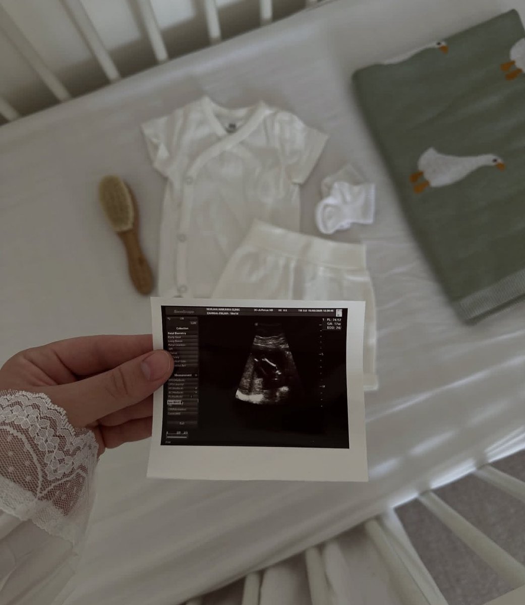 أن تغرق بحب أحدهم قبل أن تراه 
، آللهم هون عليا ما تبقى من حملي و يسر ولادتي في ساعة فرح لا تعب فيها ولا مشقة 🥹👼🏻🤰🏼
Baby Firas 💙💙💙