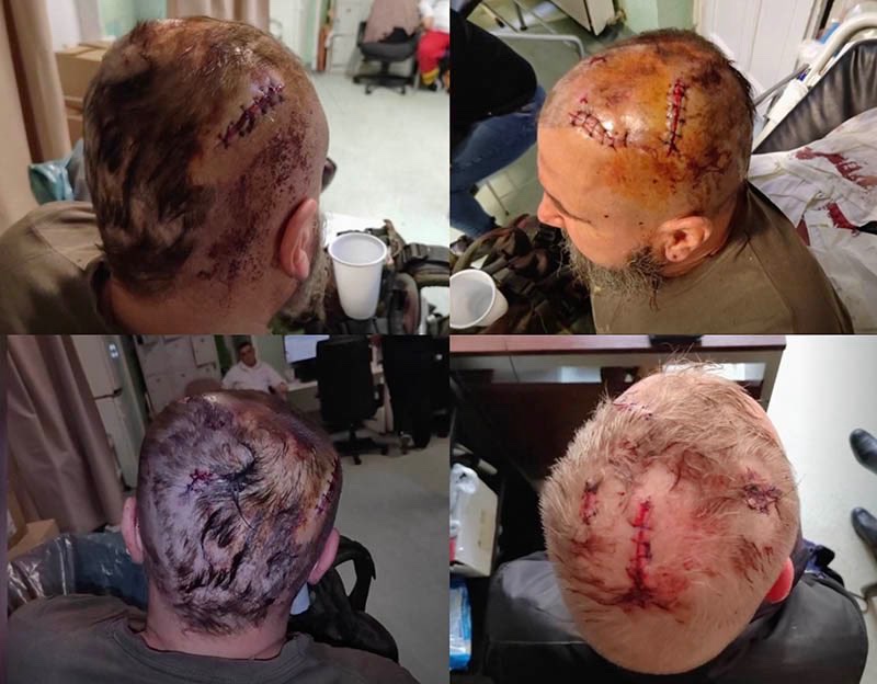 AlexSchaumburg's tweet image. Bin gespannt: @dieLinke will nicht genannt werden, wenn man diese Fotos der Opfer des Terroristen Simeon "Maja" Trux postet. Anderenfalls wird man gemeldet. Wirklich?

Die Opfer haben übrigens teils mit lebenslangen Folgen zu kämpfen - und waren mehrfach völlig unbeteiligte…