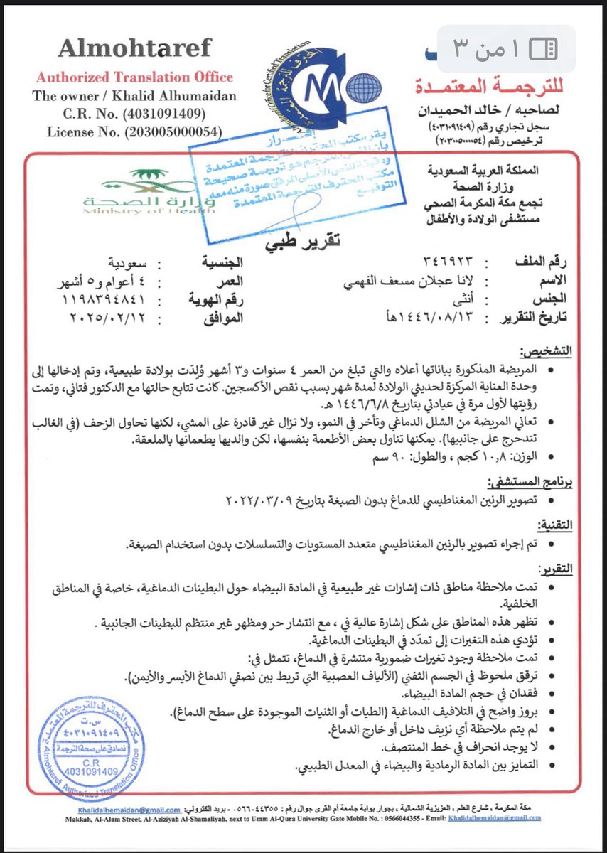 #علاج_لانا_في
