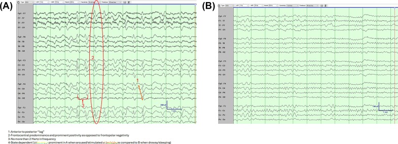 IFCN and its Clinical Neurophysiology journals tweet media