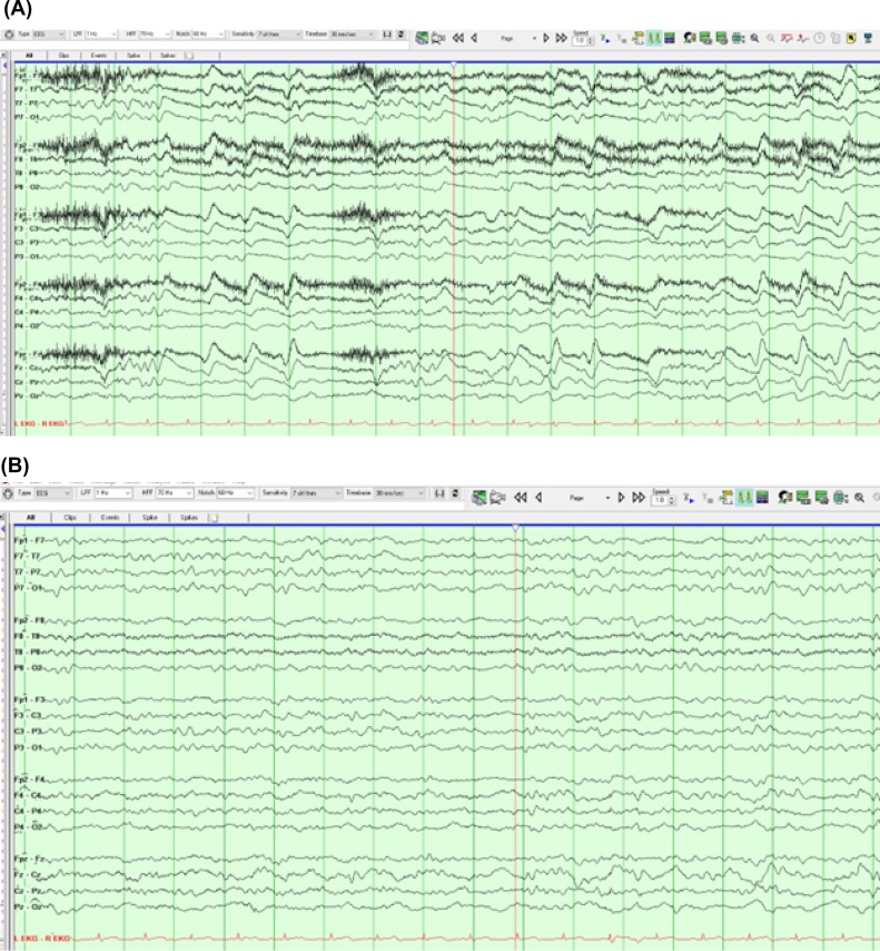 IFCN and its Clinical Neurophysiology journals tweet media