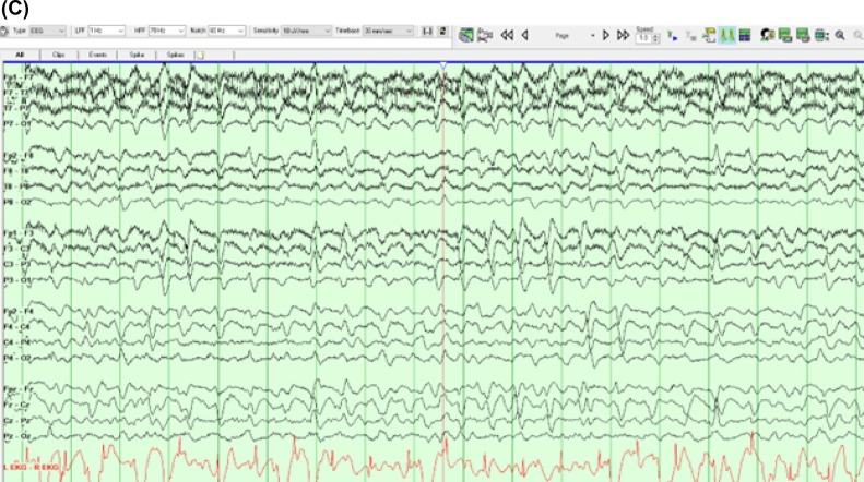 IFCN and its Clinical Neurophysiology journals tweet media