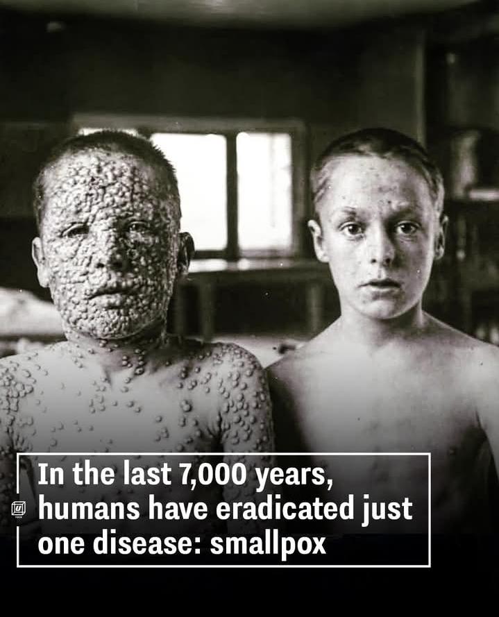 Only one disease nje, that's how hard it is