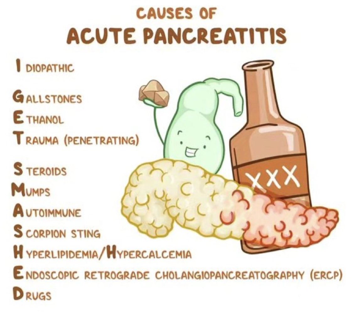 Causes of acute pancreatitis <a href="/OsmosisMed/">Osmosis from Elsevier</a>