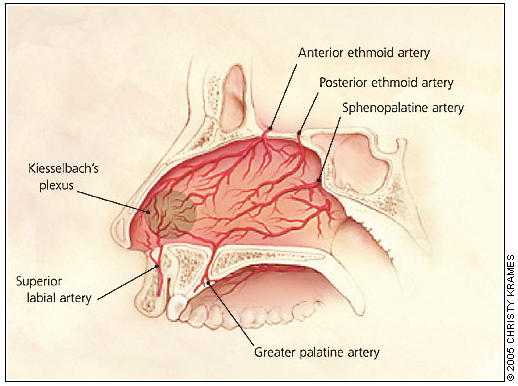 Uncontrolled nosebleed? Think beyond anterior. Posterior epistaxis needs a different game plan - recognize it early, manage decisively 🩸👃📚 #MedEd #FOAMed #EMBound

Learn more: ow.ly/KQaG50WagxB