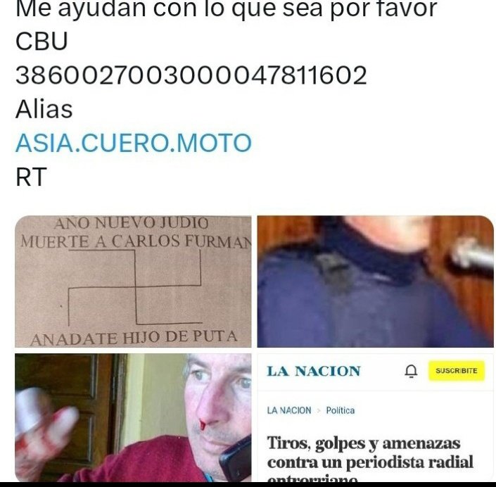 Hagan el milagro para que yo deje de sufrir y pueda volver a vivir por el amor de Dios🙏
Necesito con suma urgencia remedios,hacer estudios médicos,rehabilitación,etc.
Terrible dolores, fiebre,frío,etc.
Si les sobra un vuelto,el valor de café,una limosna,ayúdenme por piedad 🙏RT