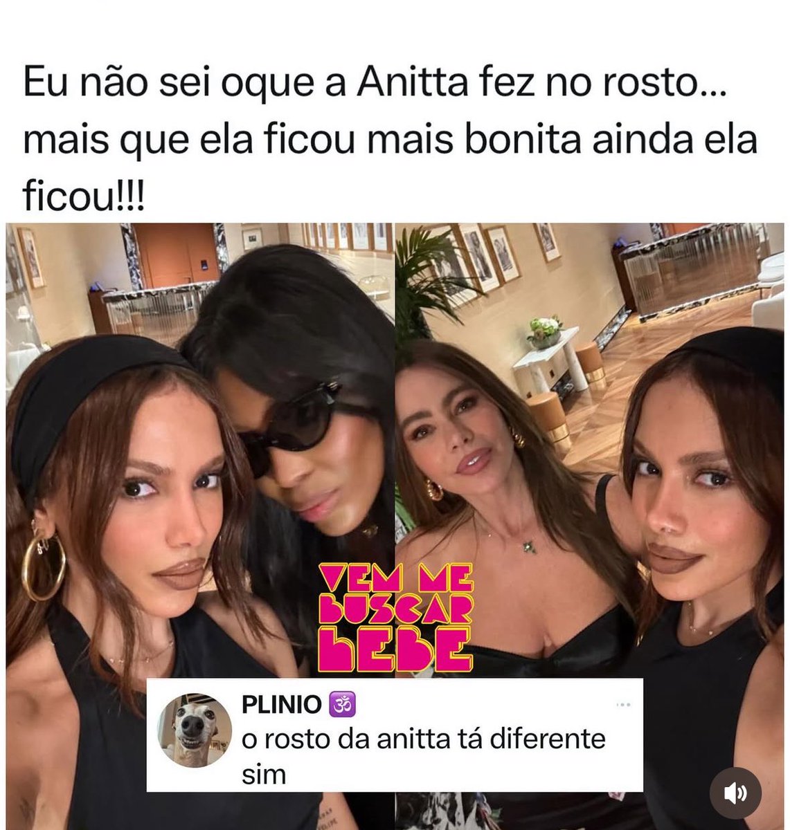 kenhumanofc's tweet photo. Vamos la, o que vocês acham que mudou? Eu achei que foi a distancia do nariz pra boca. Tá menos cara de cavalo. E vocês? #anitta https://t.co/EilmYik3W5
