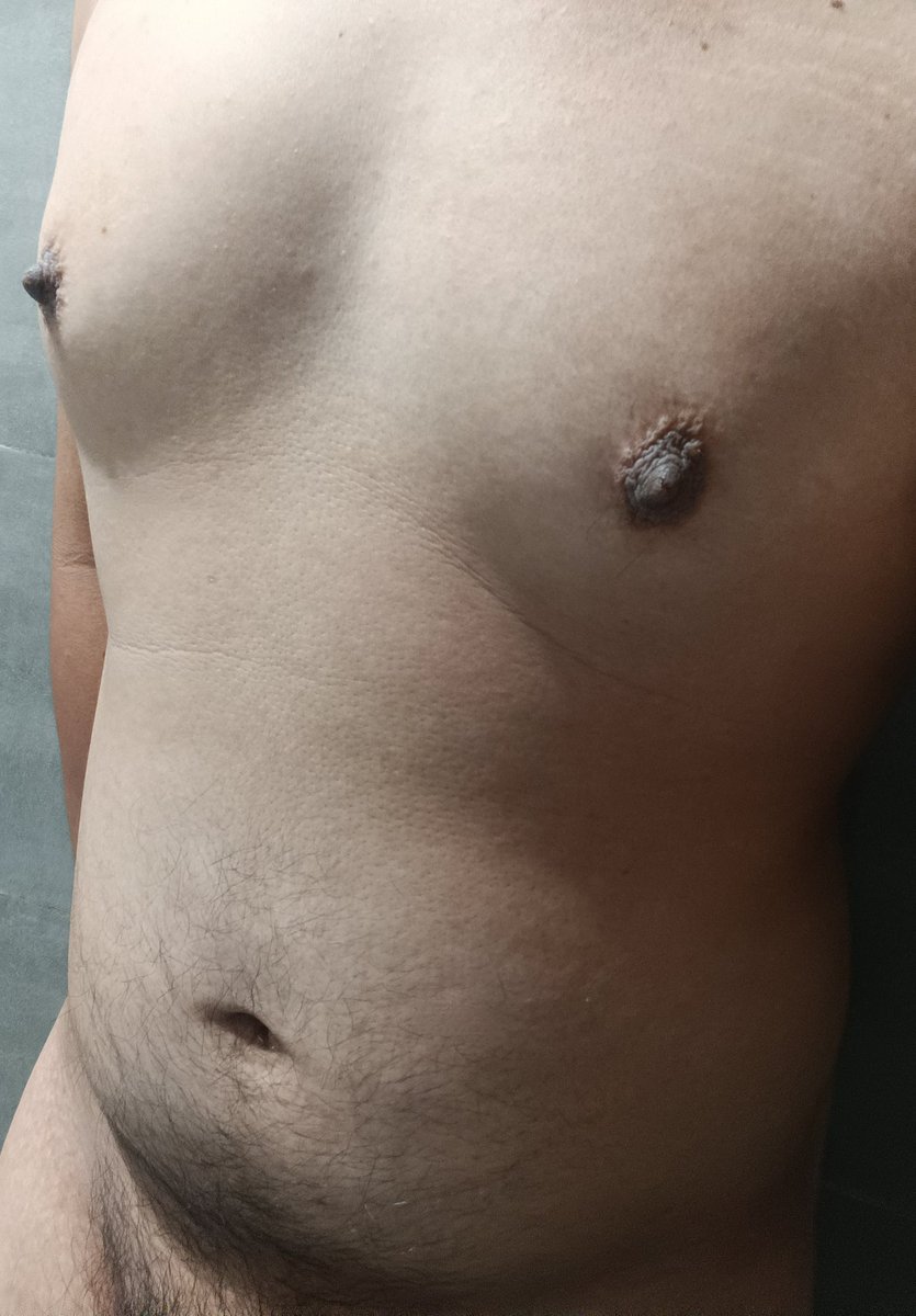 nipple feeder tweet media