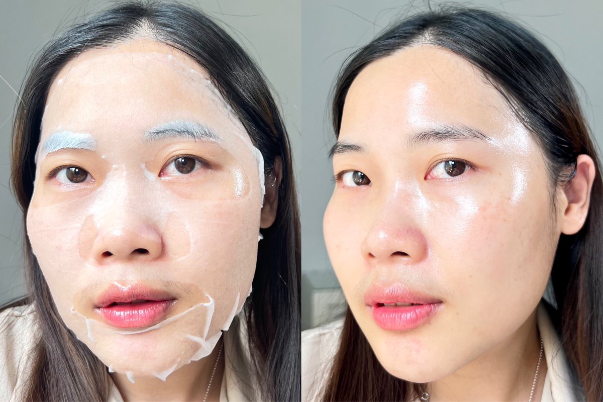 ไอเทมที่ขาดไม่ได้ 🩵✨ ยกให้เลยมาส์ก NEEDLY CROSS BARRIER แผ่นมาส์กบาง พอดีหน้า หลังมาส์กผิวโคตรจะฉ่ามมมมม หน้าชุ่มชื้นแบบสุดๆ 🩵✨ นางช่วยสร้างเกราะป้องกันผิวให้แข็งแรงด้วย 

💖เช้ารีบๆมาส์ก 1-3  นาทีก็ได้ หรือเย็นก่อนนอน มาส์กทิ้งไว้ 10-20 นาทีได้เลย ผิวฉ่ามดีชอบบบบ