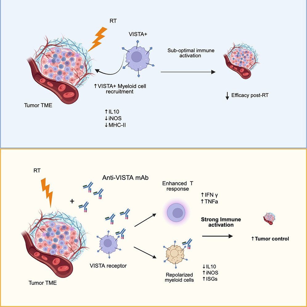 Waggoner Lab (@labwaggoner) on Twitter photo VISTA immune checkpoint blunts radiotherapy-induced antitumor immune response <a href="/CellReports/">Cell Reports</a> <a href="/dnambiar_86/">Dhanya Nambiar</a> <a href="/Qle_stanford/">Quynh Thu Le</a>
cell.com/cell-reports/f… VISTA immune checkpoint blunts radiotherapy-induced antitumor immune response <a href="/CellReports/">Cell Reports</a> <a href="/dnambiar_86/">Dhanya Nambiar</a> <a href="/Qle_stanford/">Quynh Thu Le</a>
cell.com/cell-reports/f…