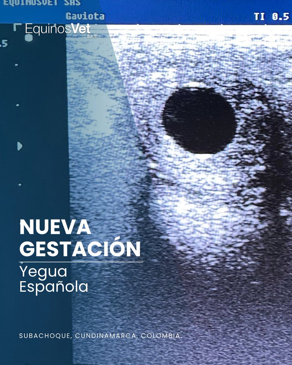 🐎 ¡Confirmado! Una nueva cría viene en camino.

📷 Ecografía transrectal: la imagen revela una vesícula embrionaria de 15 días.

🙏 Gracias a los propietarios por confiar en nuestro trabajo y permitirnos acompañarlos en este viaje.