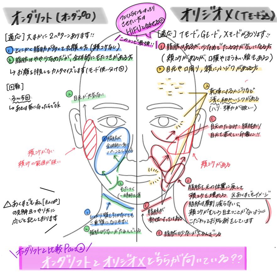 beauty_ns_kin's tweet photo. \オンダプロとオリジオXどっちが向いてる??/

今回は、オンダプロによるオンダリフト（オンダリフティング）とオリジオX（Tモード含む）比較です☝️
⚠️あくまでも個人的な（きんぱによる）見解です

どちらが自分に向いているのか...と悩んでいたけど、先日の比較画像を見て決められたというお声をいただくのでオリジオXとも比較をまとめてみました🔥
（頬コケがある方もオンダプロのお施術はモードや範囲を選定・調整すれば可能です▶︎担当の看護師さんにご相談ください✨）

画像を見て分かるかと思うので...
ひとまず画像を参考にしてみていただければ!!!

🌟たるみが気になり、フェイスラインをピタッとはっきりした印象を求める方は、オリジオXとHIFU（オリハイ）のコンビネーション治療がおすすめです☝️
▶︎私も3-6ヶ月に1回は上記組み合わせで施術をしています✋

🌟脂肪はある程度あるが、たるみも気になる方は、オンダリフトがおすすめです☝️

UBCLINICにオンダプロが導入されましたので、是非前に投稿したオンダ（旧型）とオンダプロの違いもご参考にしていただければ幸いです🥺

既に多くのご予約をいただいておりますので、ご希望の方はお早めにご予約いただけますと幸いです🗓️

#onda #オンダ #ondapro #オンダプロ #オンダリフティング #オンダリフト #オリジオ #オリジオX #美容看護師 #美容クリニック #美容皮膚科く