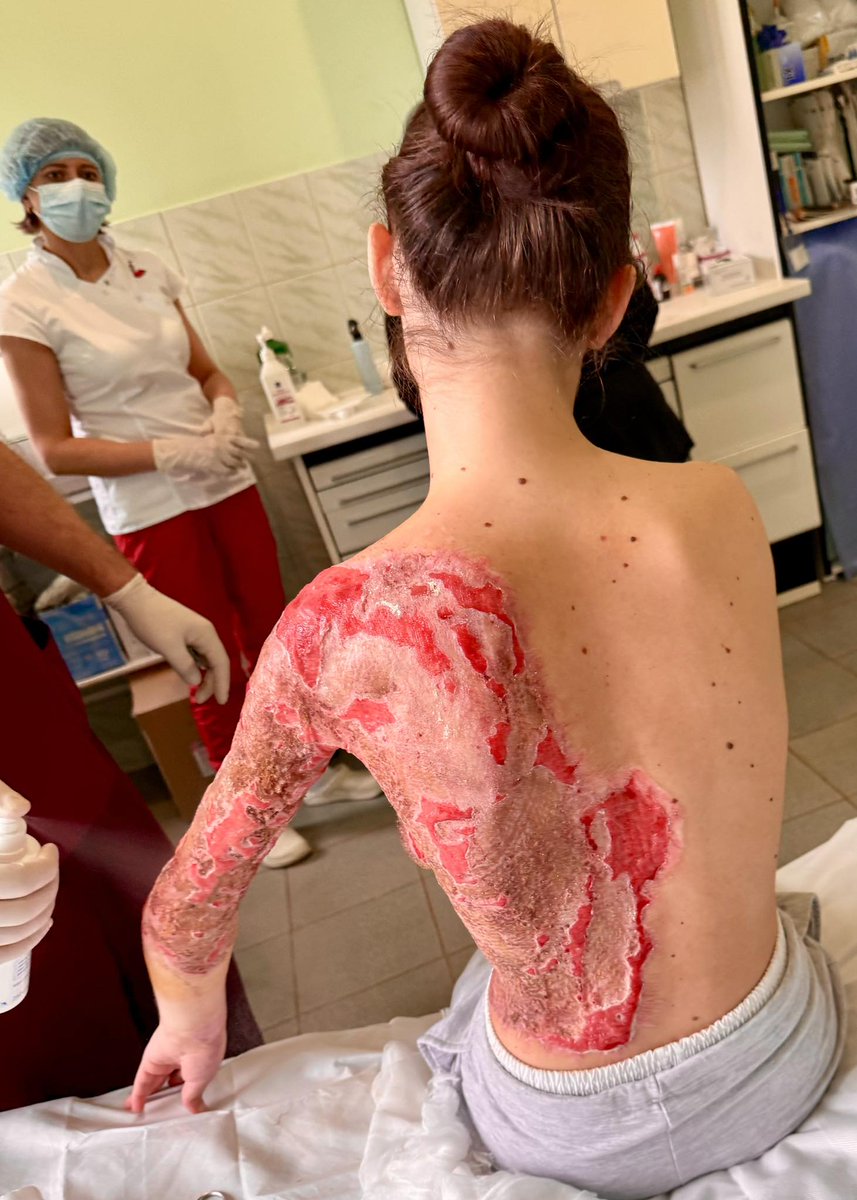 What surviving a Russian attack looks like for many Ukrainians: