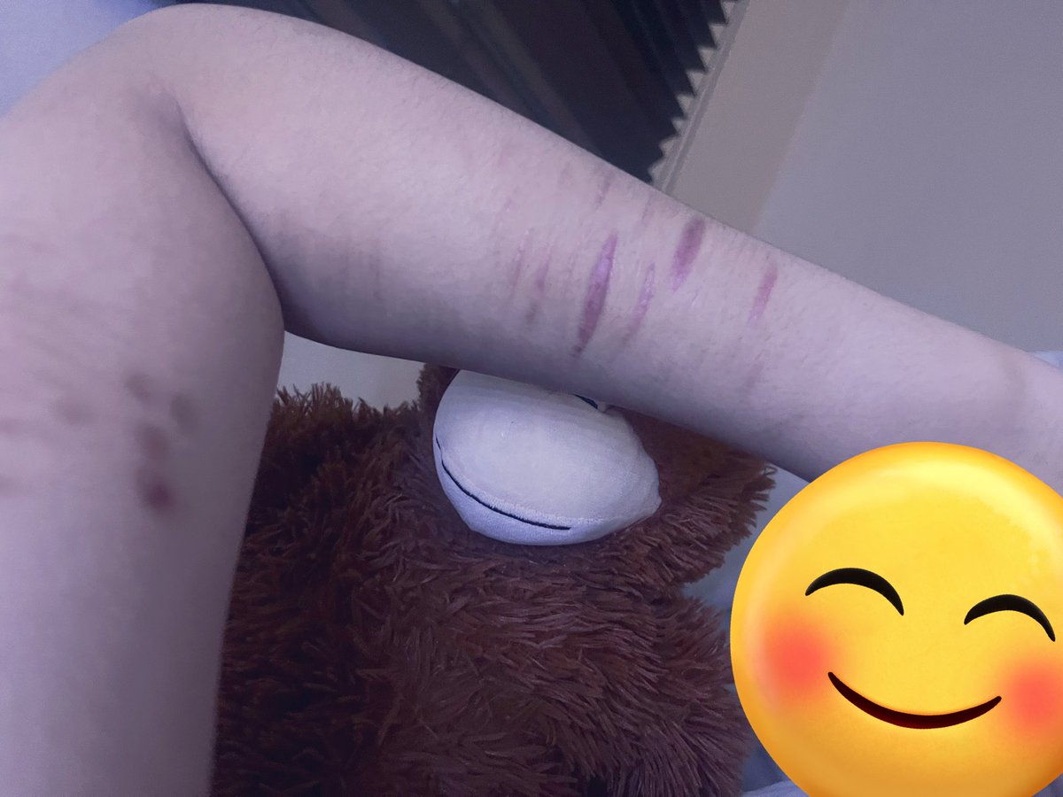 나는 존나 약골이구ㄴㄴ아..