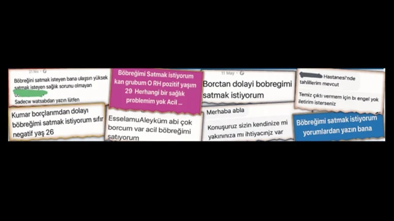 📌İşini kaybeden, borca batan, ailesine yük olmak istemeyen yüzlerce kişi internet üzerinden ‘böbreğimi satmak istiyorum’ ilanı veriyor.

Türk Ceza Kanunu 9 yıla kadar hapis öngörse de, yurttaşlar “Borçlarımı ödemek için canımdan geçmeye razıyım” diyor.

(SÖZCÜ-Meral Danyıldız)