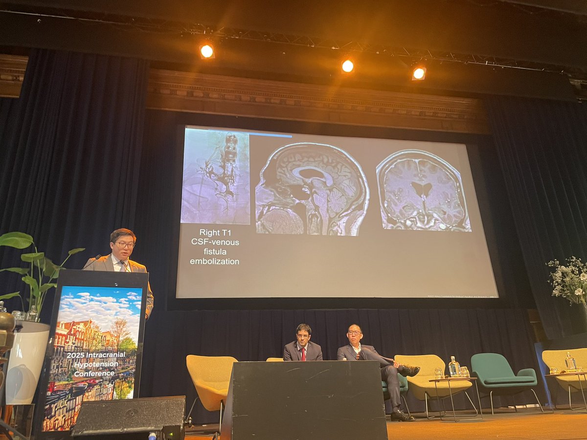 Peter Kranz (@petergkranz) on Twitter photo More controversy! <a href="/ThienHuynh15/">Thien Huynh</a> advocates for transvenous embolization in CVFs at Amsterdam #SIH conference. More controversy! <a href="/ThienHuynh15/">Thien Huynh</a> advocates for transvenous embolization in CVFs at Amsterdam #SIH conference.