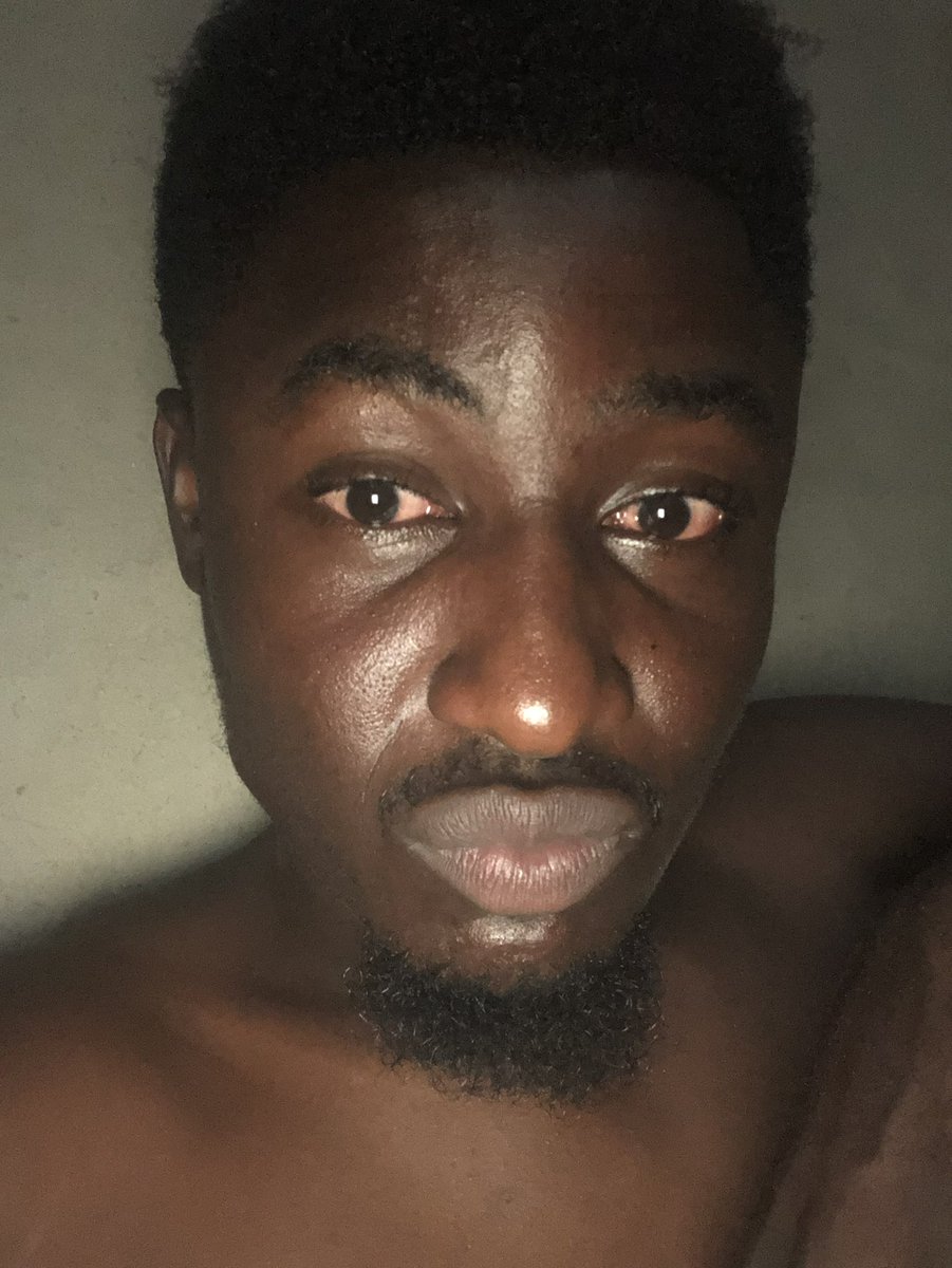 DAVID OYIN tweet media