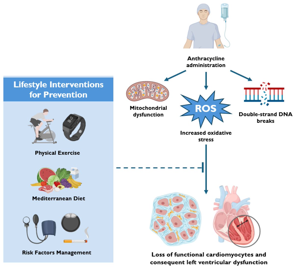 Giuseppe Biondi-Zoccai (@gbiondizoccai) on Twitter photo Lifestyle and Pharmacological Interventions to Prevent Anthracycline-Related Cardiotoxicity in Cancer Patients, by Luigi Spadafora et al mdpi.com/2308-3425/12/6… <a href="/LuigiSpadafora/">Luigi Spadafora</a> Lifestyle and Pharmacological Interventions to Prevent Anthracycline-Related Cardiotoxicity in Cancer Patients, by Luigi Spadafora et al mdpi.com/2308-3425/12/6… <a href="/LuigiSpadafora/">Luigi Spadafora</a>