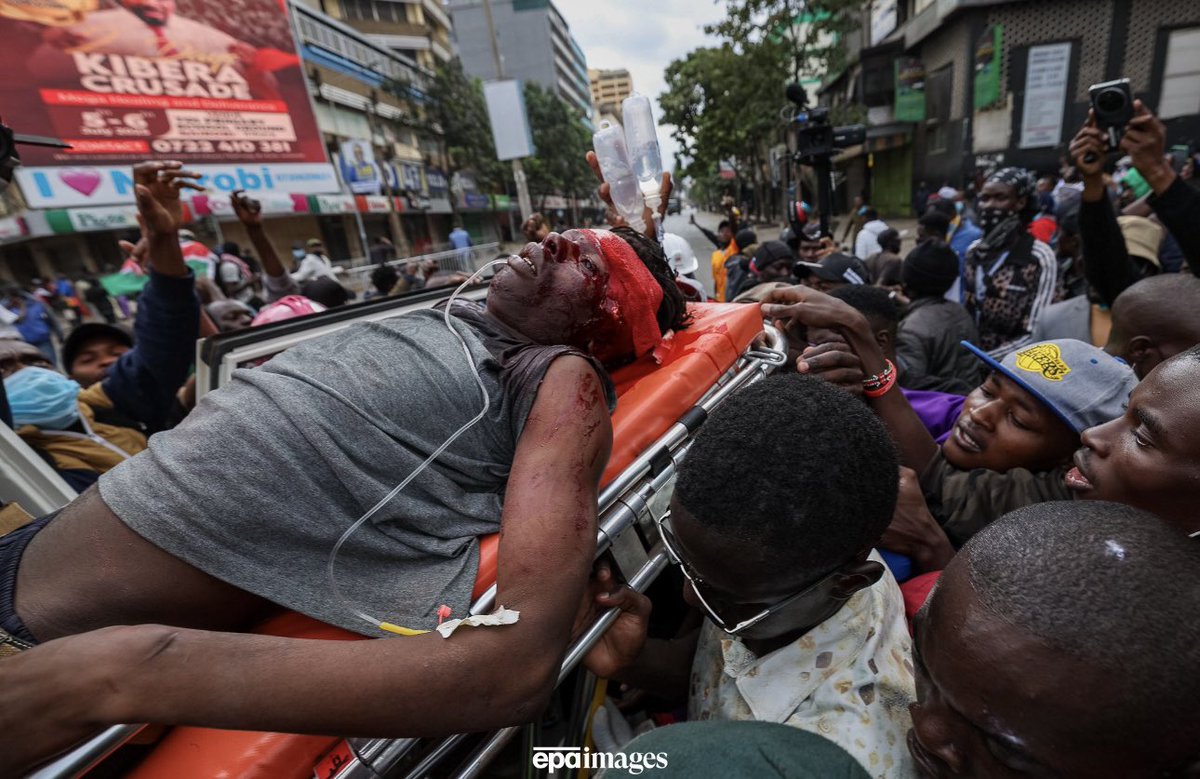 Boniface Kariuki’s death is an open, clear and daylight extrajudicial killing.

When they put police officers to guard the ICU at Kenyatta Hospital, it was clear that the government wanted to control when the announcement of Boniface’s demise will be made.

Brain dead is almost