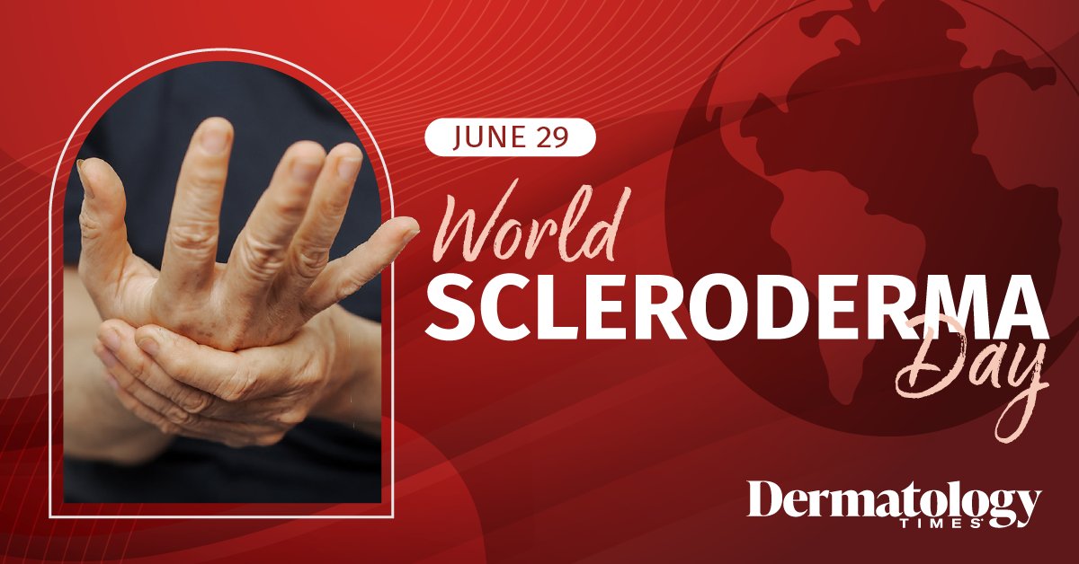 DermTimesNow's tweet image. 🌟 Happy World Scleroderma Day! Today and every day, Dermatology Times is raising awareness and advocating for early and advanced diagnosis and treatment options for patients with this rare autoimmune disease. 
#WorldSclerodermaDay2025 #SclerodermaAwarenessMonth #DermTwitter