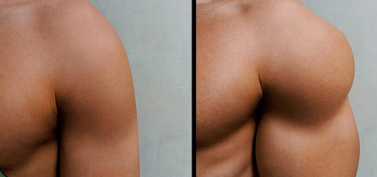 NOgymNOlimits's tweet image. Unos hombros grandes, te harán parecer GRANDE.

7 ejercicios para darles CAÑA 🔥💯👇🏼