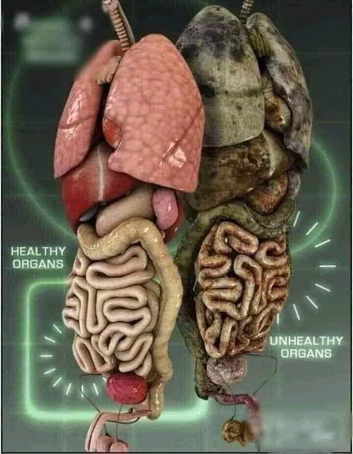 Prince_Fynnz's tweet photo. Top CANCER causing foods

VS

Anti-CANCER foods

Check Thread 👇 https://t.co/XCfAYu7tE9
