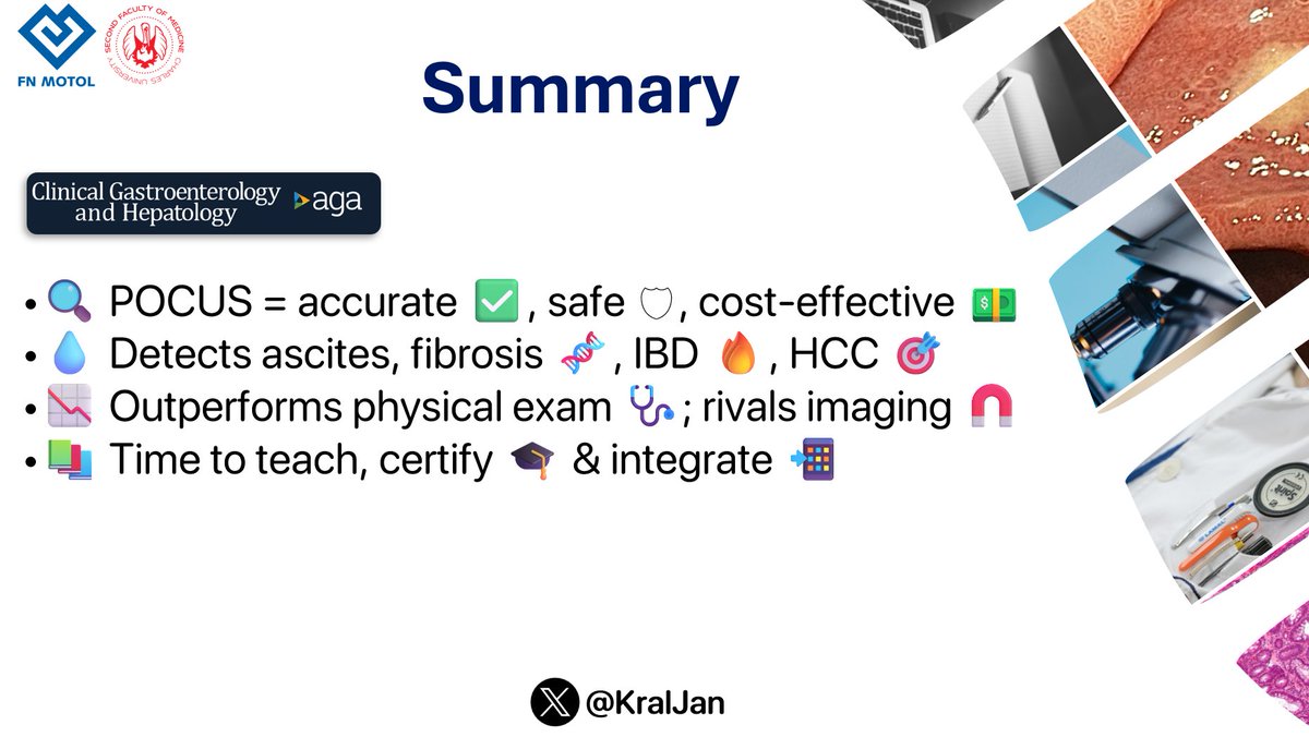 Jan Král (@kraljan) on Twitter photo 🔬 Point-of-care ultrasound (POCUS)
is revolutionizing 🌀 gastroenterology & hepatology—from diagnostics 🧪
to procedures đź’‰.
Yet formal GI training 📚 lags behind.
Time to catch up ⏳.
đź”—tinyurl.com/yyc98fyj
#GITwitter #MedTwitter #POCUS <a href="/AmerGastroAssn/">American Gastroenterological Association (AGA)</a> <a href="/AGA_CGH/">CGH</a> 🔬 Point-of-care ultrasound (POCUS)
is revolutionizing 🌀 gastroenterology & hepatology—from diagnostics 🧪
to procedures đź’‰.
Yet formal GI training 📚 lags behind.
Time to catch up ⏳.
đź”—tinyurl.com/yyc98fyj
#GITwitter #MedTwitter #POCUS <a href="/AmerGastroAssn/">American Gastroenterological Association (AGA)</a> <a href="/AGA_CGH/">CGH</a>